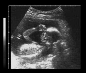 ultrasound image